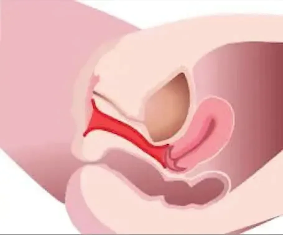 女性器の詳細
